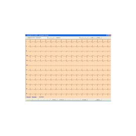 ASPEL ECG CARDIOTEKA v.211SOFT (Oprogramowanie)   - do elektrokardiograficznych badań spoczynkowych