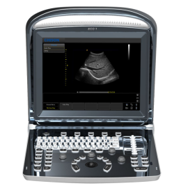 Chison ECO 1 aparat USG bez akumulatora | sonda wypukła (C3-A)