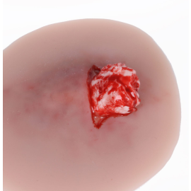 Imitacja rany - otwarte złamanie kostki Variante 1