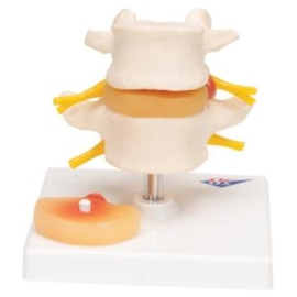 Model kręgów L4-L5 [A76]