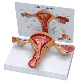 Model macicy i jajnika