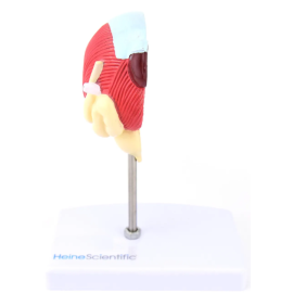 Model pęcherza i prostaty z chorobami