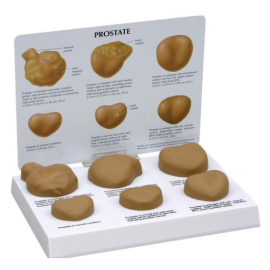Model prostaty u mężczyzn