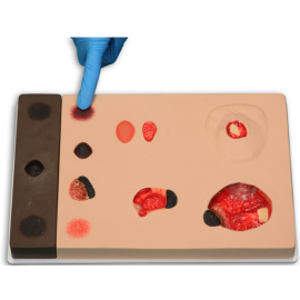 Model urazów odleżynowych