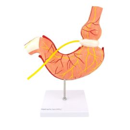 Model żołądka z opaską żołądkową