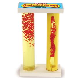 Model zwężenia tętnic z tkanką miażdżycową