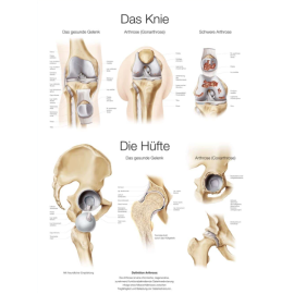 Plakat dydaktyczny "Kolano/ Biodro" w j. niemieckim