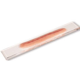 Rana chirurgiczna bez szwu - model