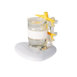 Symulator przepukliny krążka międzykręgowego