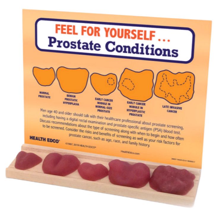 Model edukacyjny "Poczuj to sam" przedstawiający różne stany prostaty