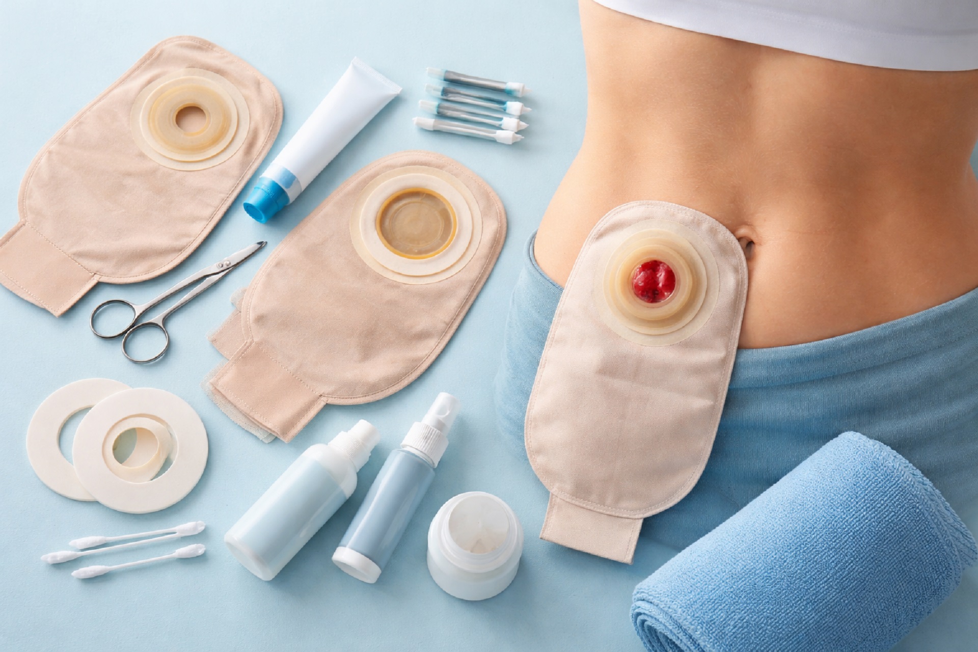 Co zmienia urostomia i jak się do niej przyzwyczaić?