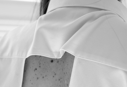 Łupież pstry - czy jest zaraźliwy?