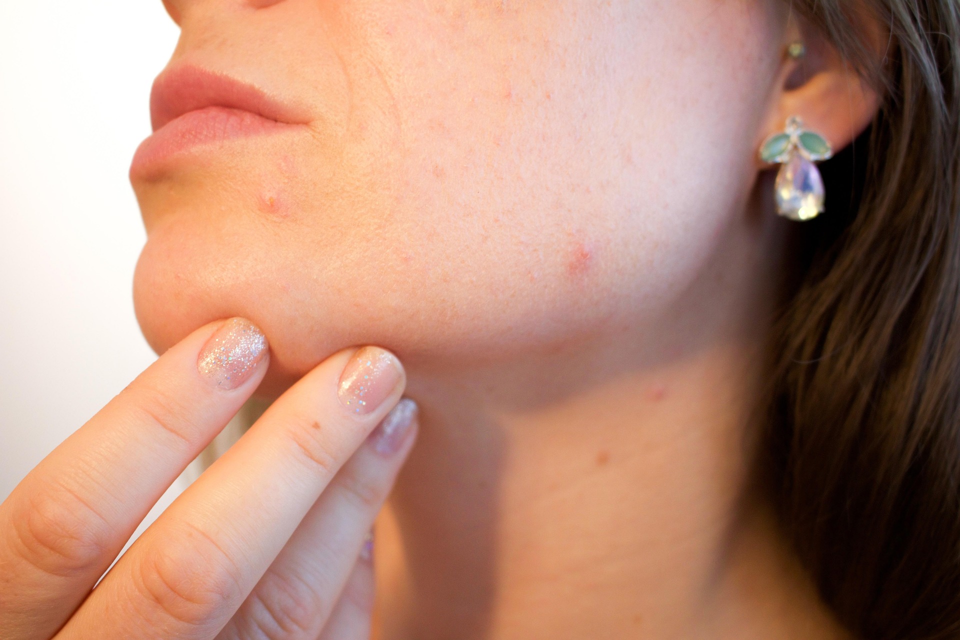 Dermatoskopia – co to jest i dlaczego warto się na nią zdecydować?