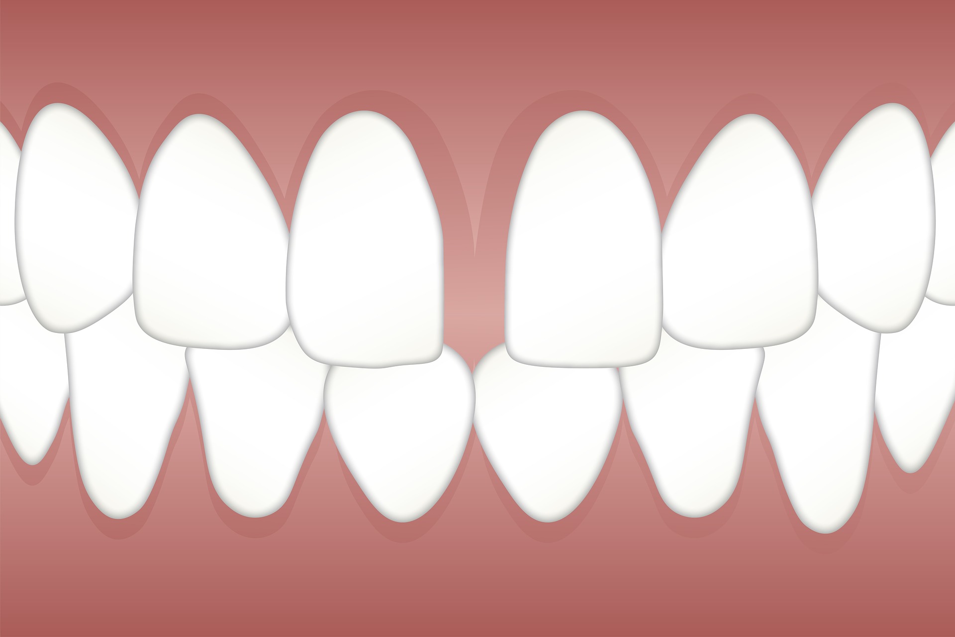 Diastema – Co to jest i jak wpływa na zdrowie jamy ustnej?