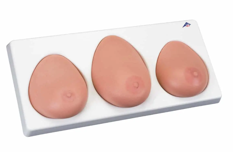 FIBROADENOMA - GRUCZOLAKOWŁÓKNIAK PIERSI