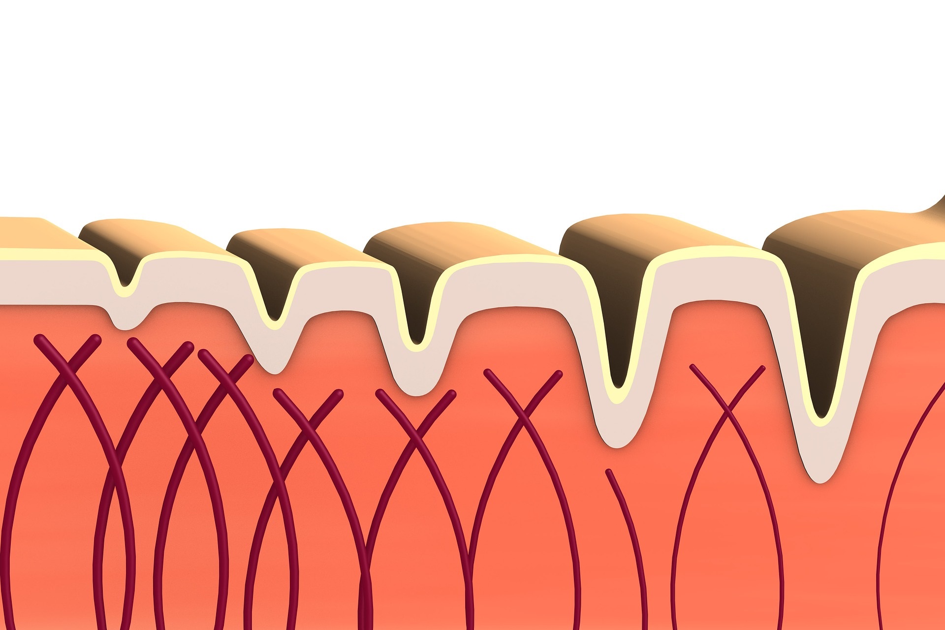 Epidermolysis bullosa (pęcherzowe oddzielanie się naskórka) 