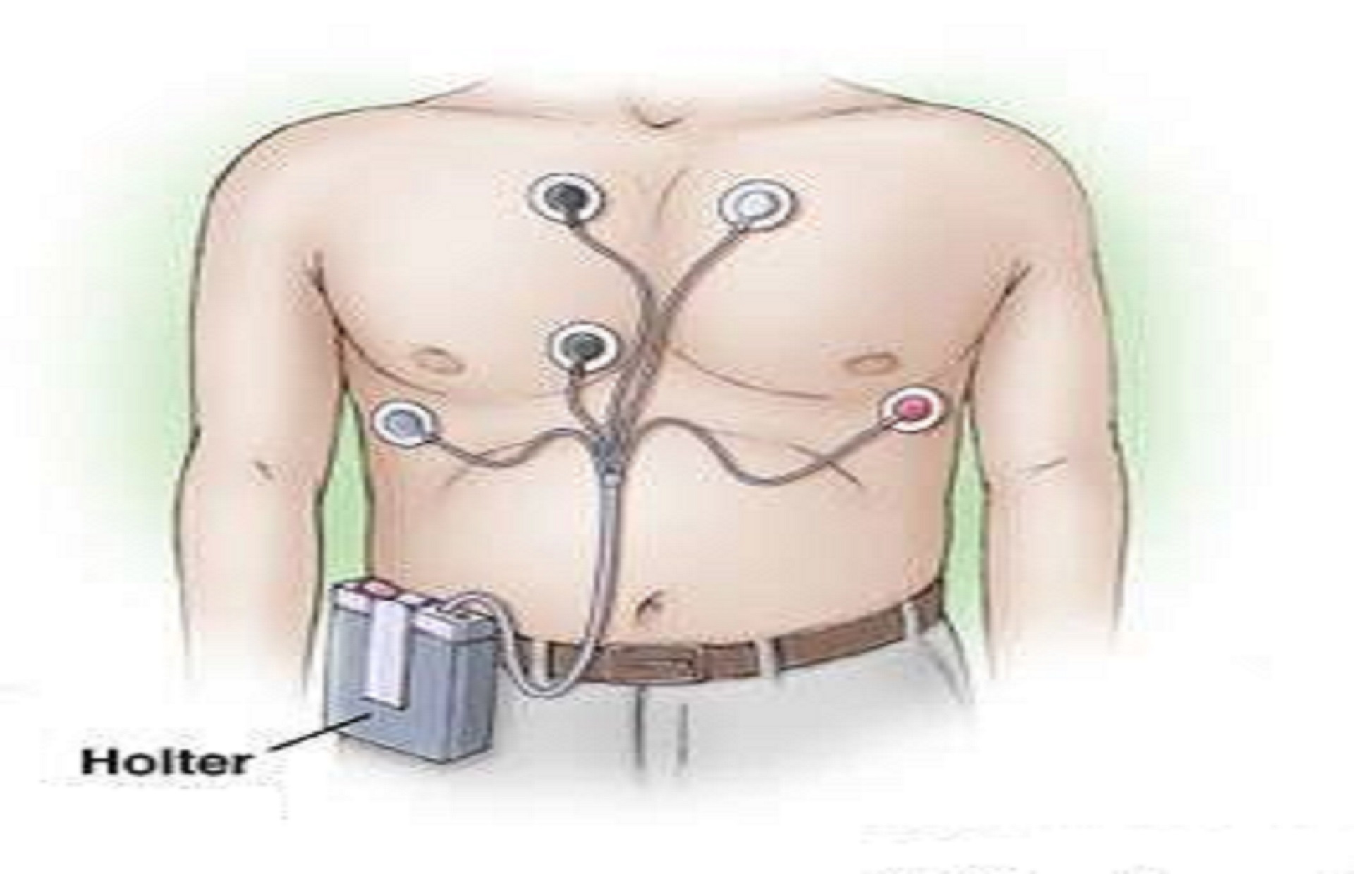 Monitorowanie EKG przy użyciu HOLTERA