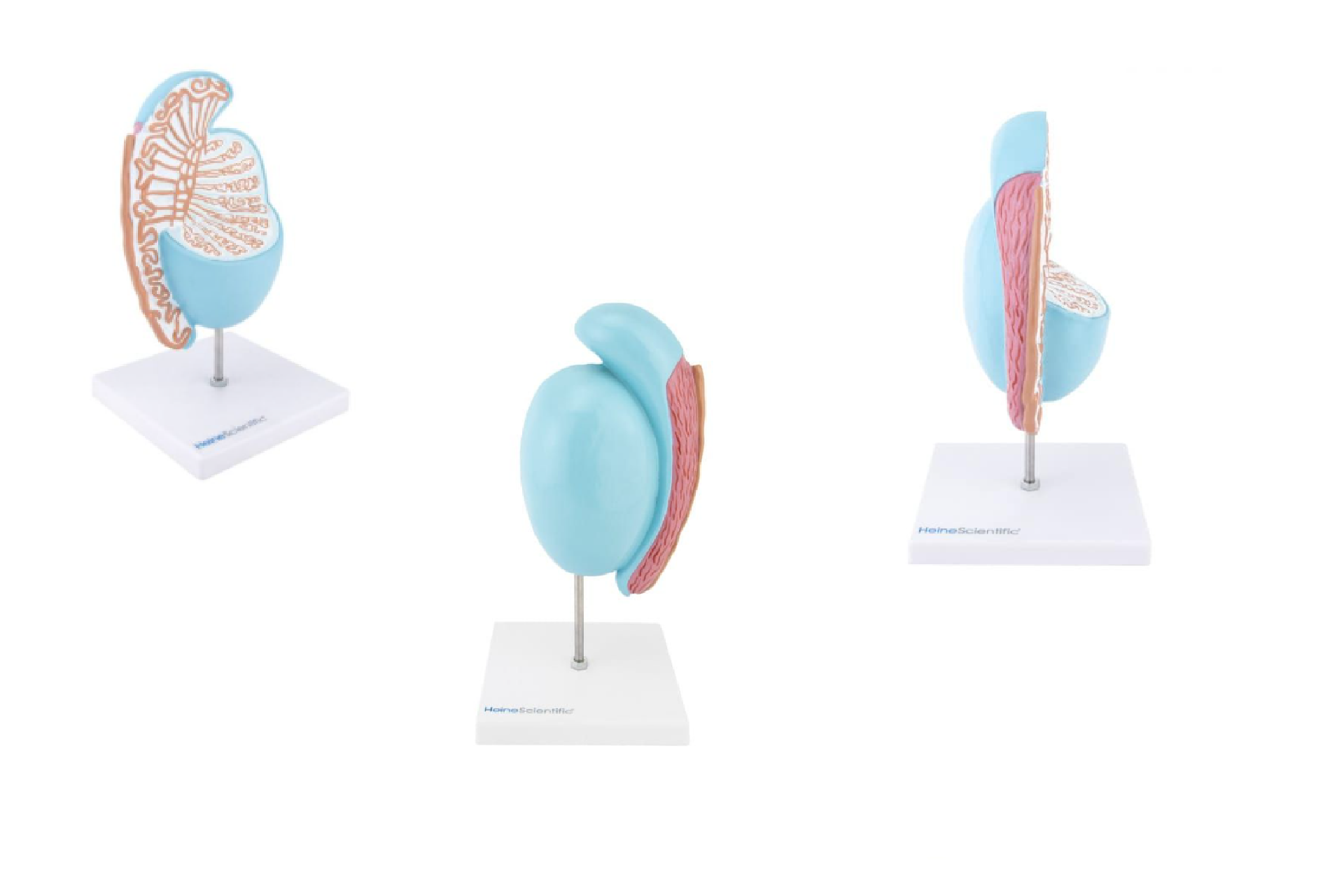 Jeden guzek, wielkie znaczenie – o raku jądra