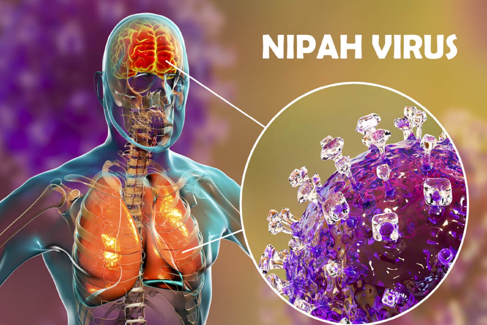 Nipah – groźny wirus powraca