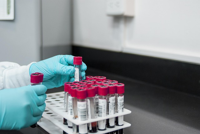 Wpływ jakości próbki na wyniki badań laboratoryjnych – jak zapewnić wiarygodność wyników.
