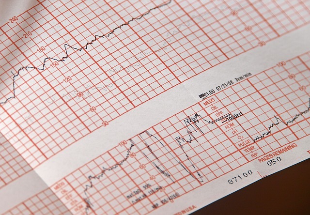 Odcinek ST (STEMI)