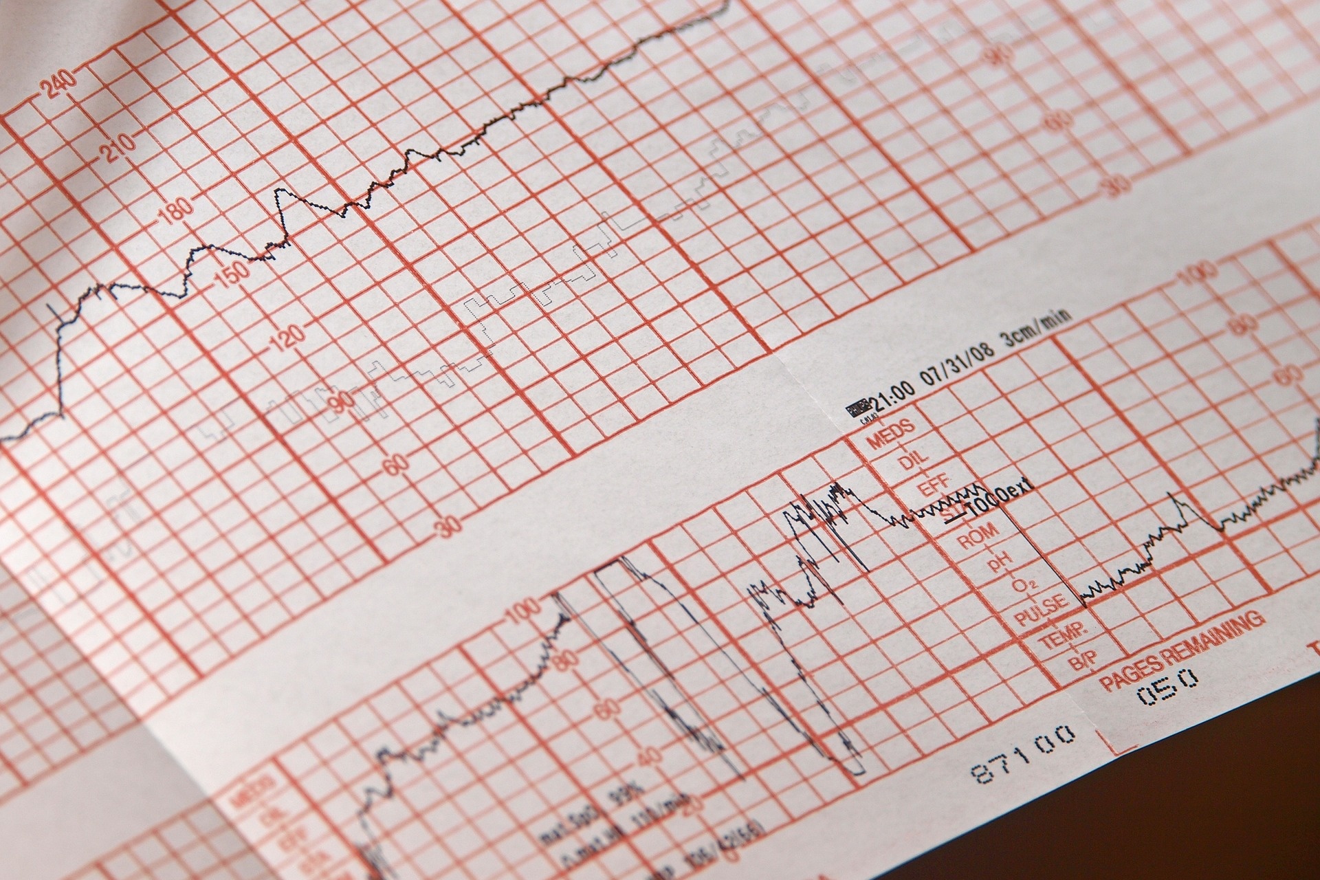 Jak odczytać zapis EKG