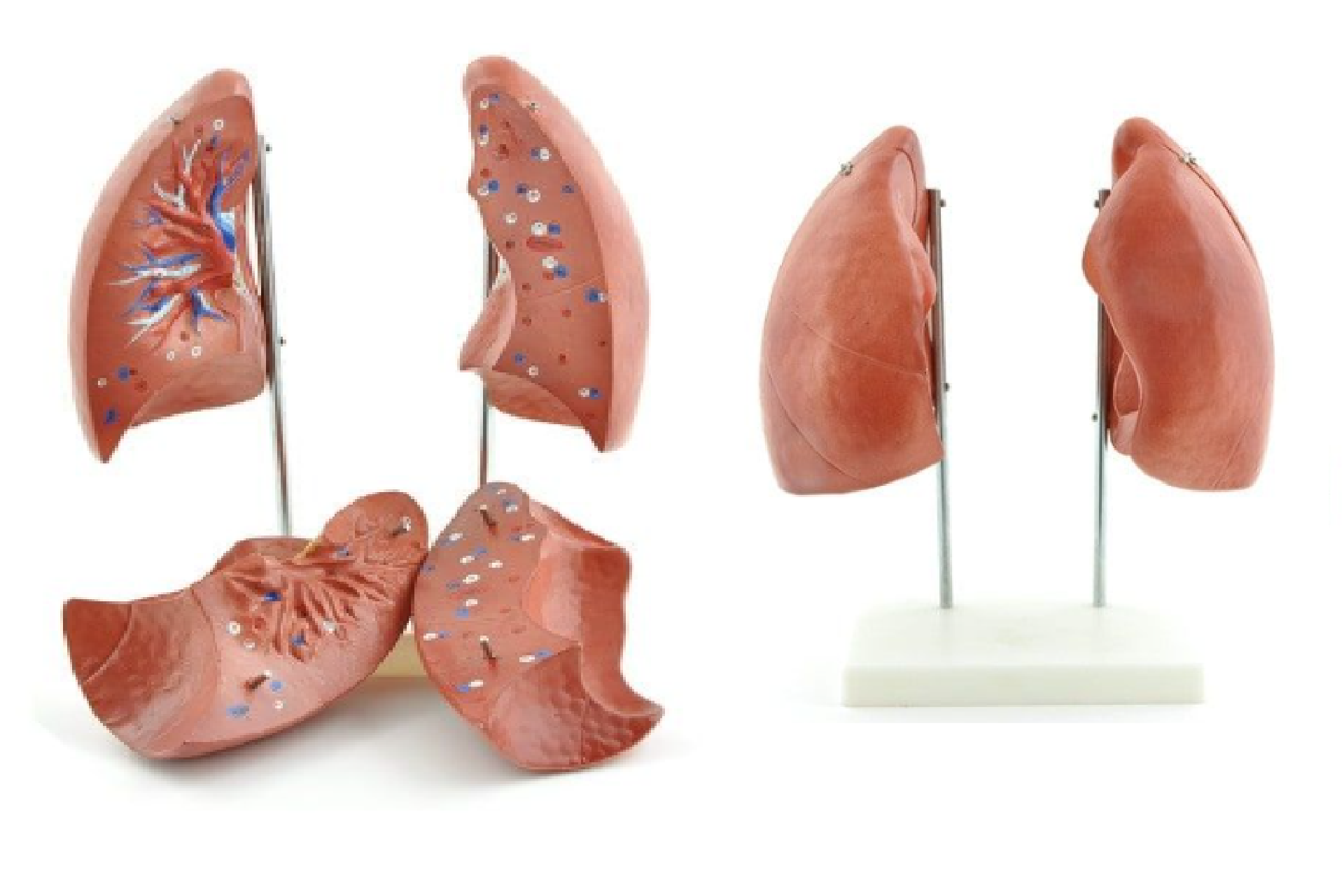 Koklusz – groźna choroba zakaźna układu oddechowego