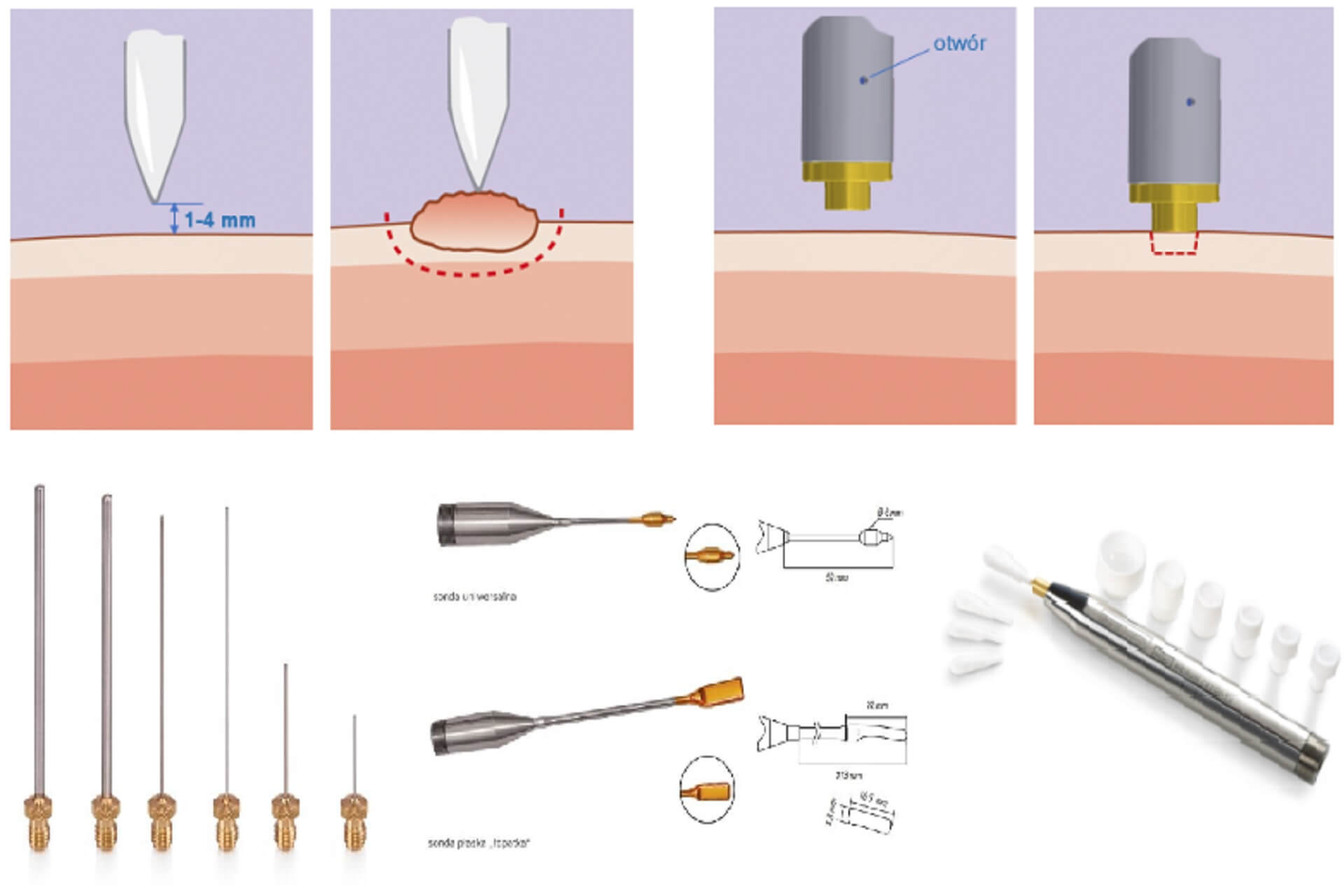 Zamrażanie zmian skórnych metodą natryskową i kontaktową – różnice