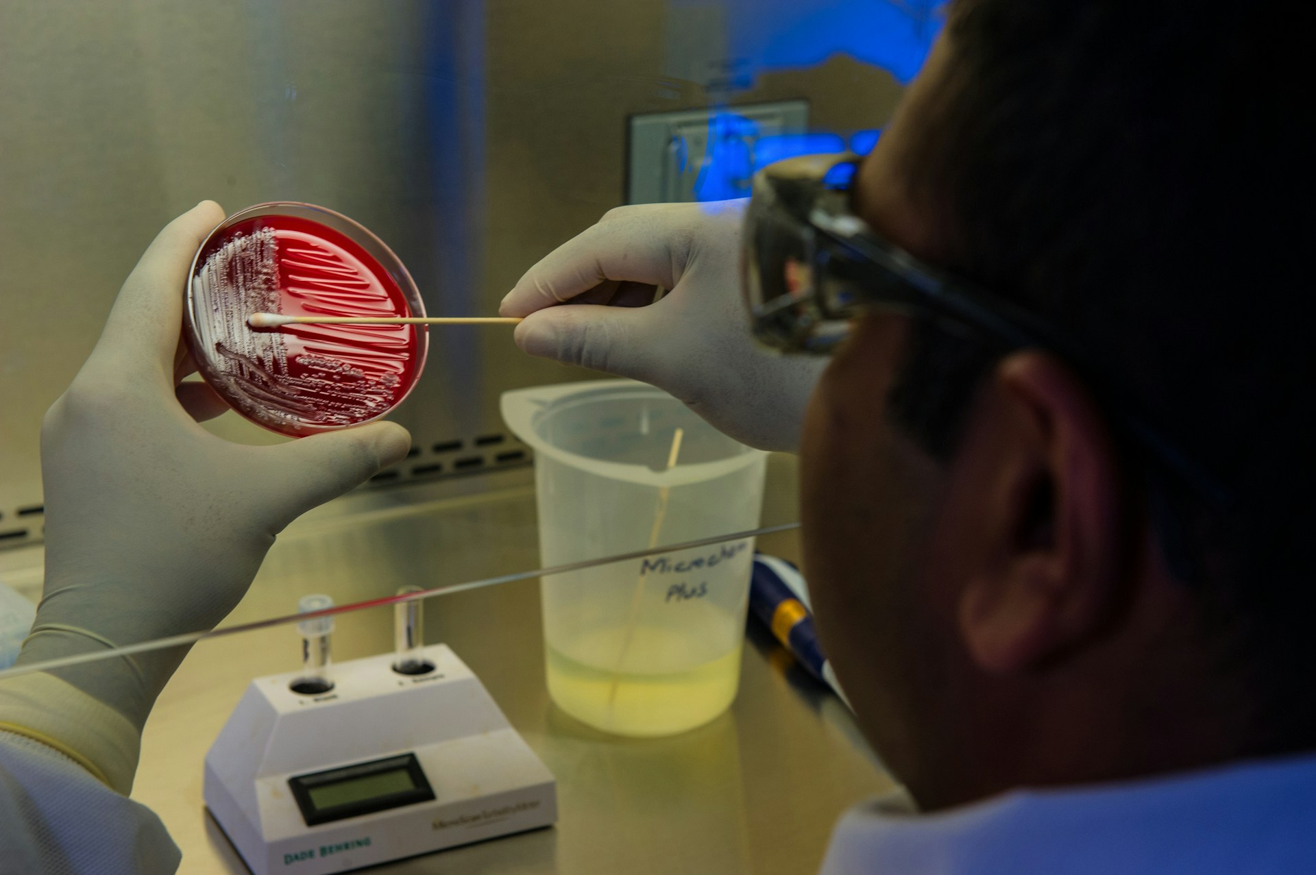 Odkrywanie świata mikroorganizmów: szalka Petriego i jej wpływ na badania naukowe